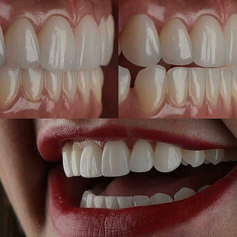 Răng đẹp hơn khi đến với Nha khoa Lê Gia